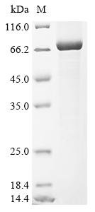 Recombinant Human Serine protease 56 (PRSS56)