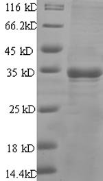 Recombinant Human Prostate stem cell antigen (PSCA), Homo sapiens (Human), E.coli, N-terminal GST-tagged, 35.7kDa, purity >90% as determined by SDS-PAGE.