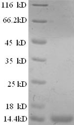 Recombinant Human Prostate stem cell antigen (PSCA), partial, Homo sapiens (Human), E.coli, N-terminal 6xHis-tagged and C-terminal 6xHis-tagged, 13.4kDa, purity >90% as determined by SDS-PAGE.