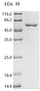 Recombinant Human 26S proteasome non-ATPase regulatory subunit 11 (PSMD11)