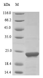 Recombinant Human Prostaglandin E synthase 3 (PTGES3)