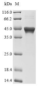 Recombinant Human Tyrosine-protein phosphatase non-receptor type 1 (PTPN1), partial