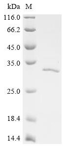 Recombinant Human Tyrosine-protein phosphatase non-receptor type 14 (PTPN14), partial, Homo sapiens (Human), E.coli, C-terminal 6xHis-tagged, 29.3kDa, purity >90% as determined by SDS-PAGE.