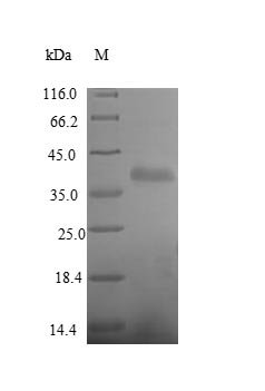 Recombinant Human Receptor-type tyrosine-protein phosphatase beta (PTPRB), partial