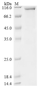 Recombinant Human Glycogen phosphorylase, brain form (PYGB) (R61A,K192A)