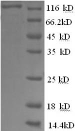 Recombinant Human Glycogen phosphorylase, liver form (PYGL), partial