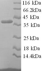 Recombinant Human Pregnancy zone protein (PZP), partial, Homo sapiens (Human), E.coli, N-terminal 6xHis-tagged, 42.3kDa, purity >90% as determined by SDS-PAGE.