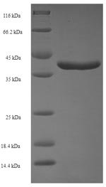 Recombinant Human Ras-related protein Rab-11A (RAB11A), Homo sapiens (Human), E.coli, N-terminal 6xHis-SUMO-tagged, 39.9kDa, purity >90% as determined by SDS-PAGE.