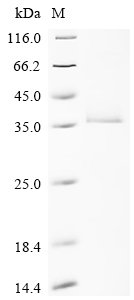 Recombinant Human Ras-related protein Rab-33A (RAB33A), Homo sapiens (Human), E.coli, C-terminal 10xHis-tagged, 34.1kDa, purity >95% as determined by SDS-PAGE.