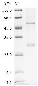 Recombinant Human Ras-related protein Rab-33A (RAB33A), Homo sapiens (Human), Mammalian cell, C-terminal 10xHis-tagged, 28.0kDa, purity >85% as determined by SDS-PAGE.