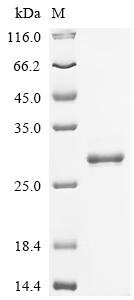 Recombinant Human Ras-related protein Rab-5C (RAB5C), Homo sapiens (Human), Mammalian cell, C-terminal 10xHis-tagged, 25.0kDa, purity >95% as determined by SDS-PAGE.