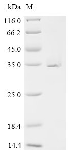 Recombinant Human Ras-related protein Rab-6A (RAB6A), Homo sapiens (Human), E.coli, C-terminal 6xHis-tagged, 30.4kDa, purity >95% as determined by SDS-PAGE.