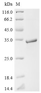 Recombinant Human Ras-related protein Rab-6B (RAB6B), Homo sapiens (Human), E.coli, C-terminal 6xHis-tagged, 30.2kDa, purity >90% as determined by SDS-PAGE.