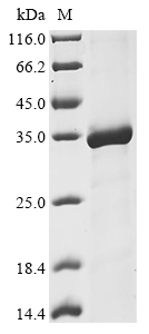 Recombinant Human DNA repair protein RAD50 (RAD50), partial, Homo sapiens (Human), E.coli, N-terminal 10xHis-tagged and C-terminal Myc-tagged, 34.1kDa, purity >90% as determined by SDS-PAGE.