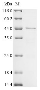 Recombinant Human RAD51-associated protein 1 (RAD51AP1)