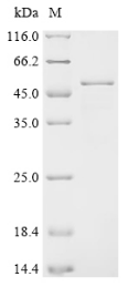 Recombinant Human GTP-binding nuclear protein Ran (RAN)