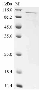 Recombinant Human Rap1 GTPase-activating protein 1 (RAP1GAP)