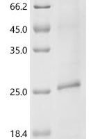 (Tris-Glycine gel) Discontinuous SDS-PAGE (reduced) with 5% enrichment gel and 15% separation gel.