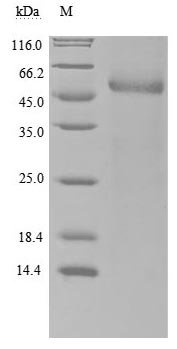 Recombinant Human Retinol-binding protein 4 (RBP4) (Active), Homo sapiens (Human), Mammalian cell, C-terminal hFc1-tagged, 50.0kDa, purity >90% as determined by SDS-PAGE.