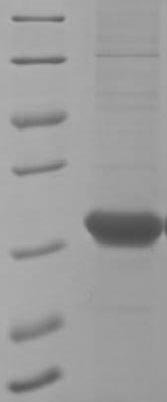 Recombinant Human Recoverin (RCVRN)
