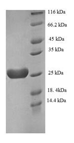 Recombinant Human Recoverin (RCVRN), Homo sapiens (Human), E.coli, N-terminal 6xHis-tagged, 27.0kDa, purity >90% as determined by SDS-PAGE.