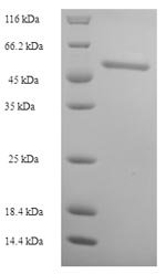 Recombinant Human Retinol dehydrogenase 12 (RDH12)