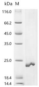 Recombinant Human ATP synthase F(0) complex subunit a (MT-ATP6) Protein, Homo sapiens (Human), in vitro E.coli expression system, N-terminal 10xHis-tagged, 26.3kDa, purity >85% as determined by SDS-PAGE.