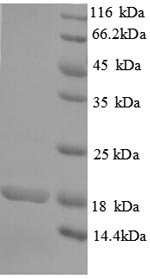 Recombinant Human Rhomboid-related protein 2 (RHBDL2), partial