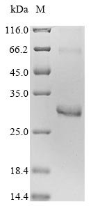 Recombinant Human Rho-related GTP-binding protein RhoD (RHOD)