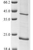 (Tris-Glycine gel) Discontinuous SDS-PAGE (reduced) with 5% enrichment gel and 15% separation gel.