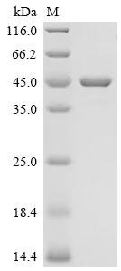 Recombinant Human Retinaldehyde-binding protein 1 (RLBP1)