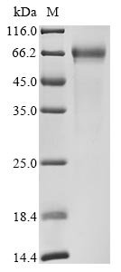 Recombinant Human Ribonuclease T2 (RNASET2)