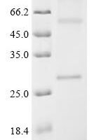 (Tris-Glycine gel) Discontinuous SDS-PAGE (reduced) with 5% enrichment gel and 15% separation gel.