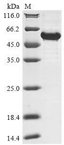Recombinant Human Nuclear receptor ROR-alpha (RORA), Homo sapiens (Human), E.coli, N-terminal 6xHis-tagged, 57.6kDa, purity >85% as determined by SDS-PAGE.