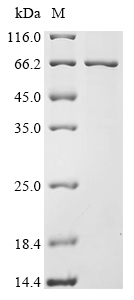Recombinant Human Retinoid isomerohydrolase (RPE65), Homo sapiens (Human), Baculovirus, N-terminal 10xHis-tagged and C-terminal Myc-tagged, 64.7kDa, purity >85% as determined by SDS-PAGE.