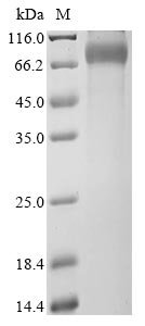 Recombinant Human X-linked retinitis pigmentosa GTPase regulator (RPGR), partial, Homo sapiens (Human), Mammalian cell, C-terminal hFc1-tagged, 62.8kDa, purity >90% as determined by SDS-PAGE.