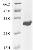 (Tris-Glycine gel) Discontinuous SDS-PAGE (reduced) with 5% enrichment gel and 15% separation gel.