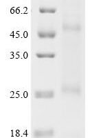 (Tris-Glycine gel) Discontinuous SDS-PAGE (reduced) with 5% enrichment gel and 15% separation gel.
