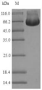 Recombinant Human RuvB-like 2 (RUVBL2), Homo sapiens (Human), E.coli, N-terminal 6xHis-SUMO-tagged, 67.0kDa, purity >90% as determined by SDS-PAGE.