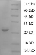 Recombinant Human Protein S100-A11 (S100A11)
