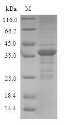 Recombinant Human Protein S100-A12 (S100A12)