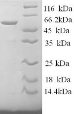 Recombinant Human S-arrestin (SAG)