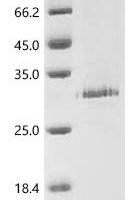 (Tris-Glycine gel) Discontinuous SDS-PAGE (reduced) with 5% enrichment gel and 15% separation gel.