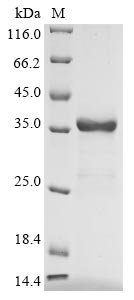 Recombinant Human Uteroglobin (SCGB1A1)