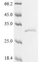 (Tris-Glycine gel) Discontinuous SDS-PAGE (reduced) with 5% enrichment gel and 15% separation gel.