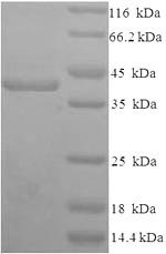 Recombinant Human Syndecan-1 (SDC1), partial, Homo sapiens (Human), E.coli, N-terminal 6xHis-SUMO-tagged, 39.9kDa, purity >90% as determined by SDS-PAGE.