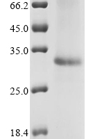 (Tris-Glycine gel) Discontinuous SDS-PAGE (reduced) with 5% enrichment gel and 15% separation gel.