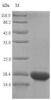 Recombinant Human Selenoprotein M (SELENOM)