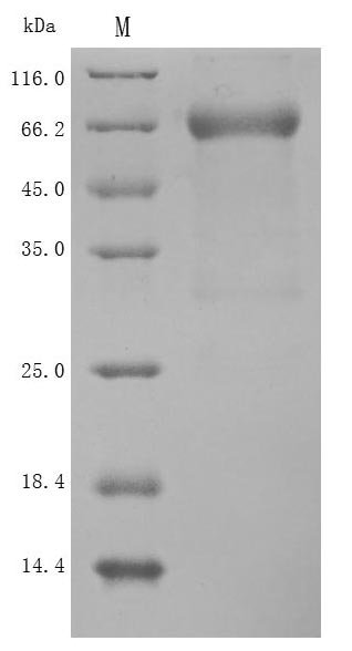 Recombinant Human Semaphorin-4D (SEMA4D), partial (Active)