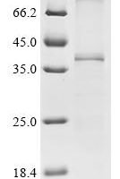 (Tris-Glycine gel) Discontinuous SDS-PAGE (reduced) with 5% enrichment gel and 15% separation gel.